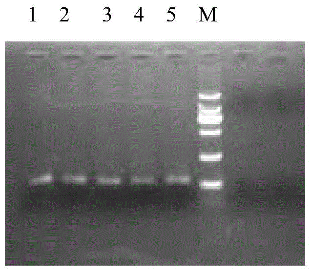 Method and special kit thereof for detecting babesia