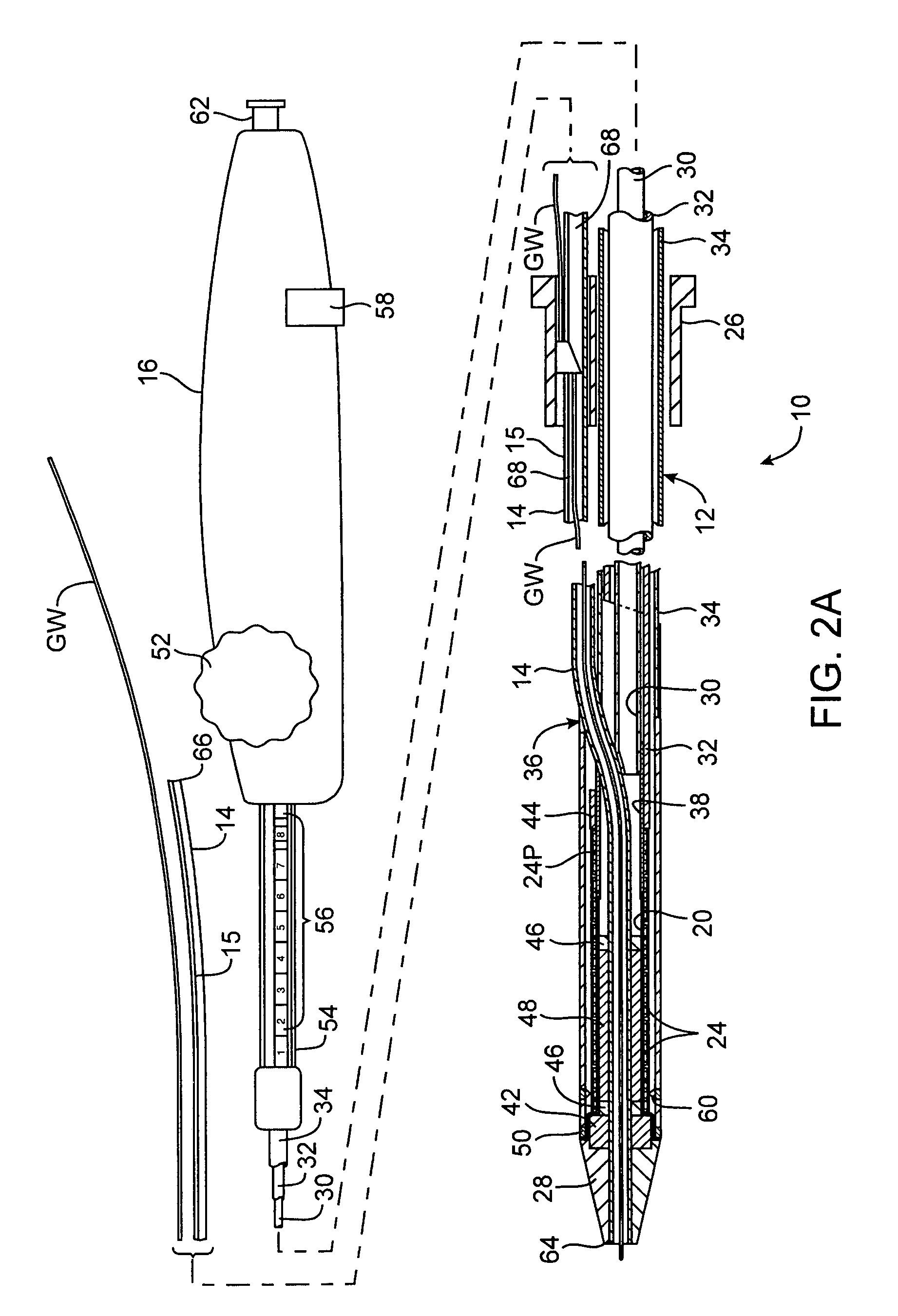 Rapid exchange interventional devices and methods