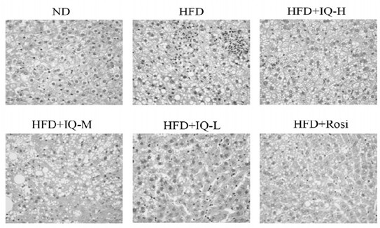 Application of isoquercetin in treatment of steatohepatitis