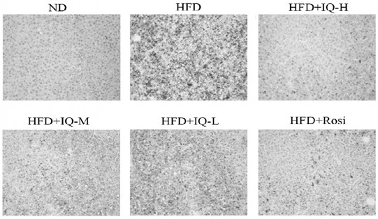 Application of isoquercetin in treatment of steatohepatitis