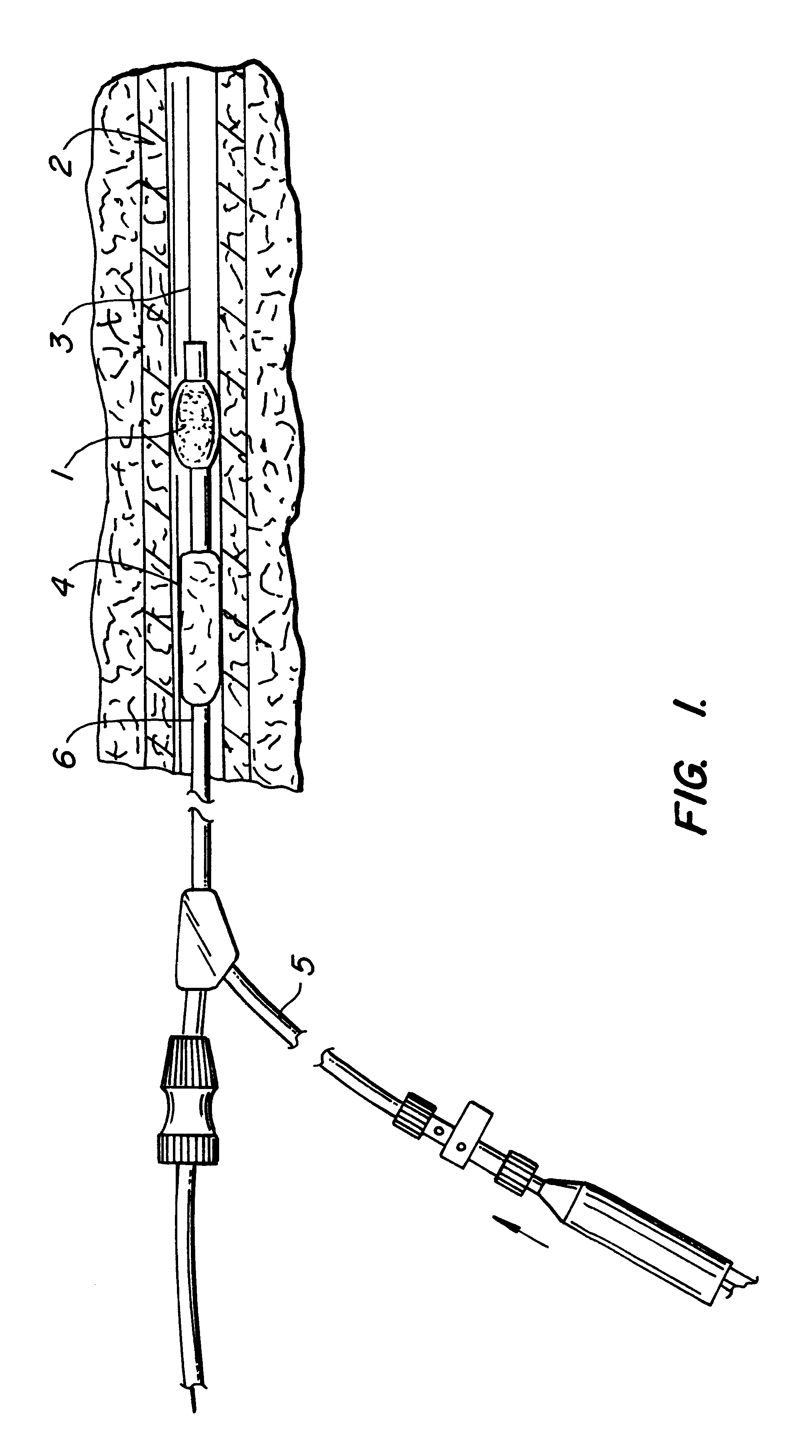 Medical device and methods for use