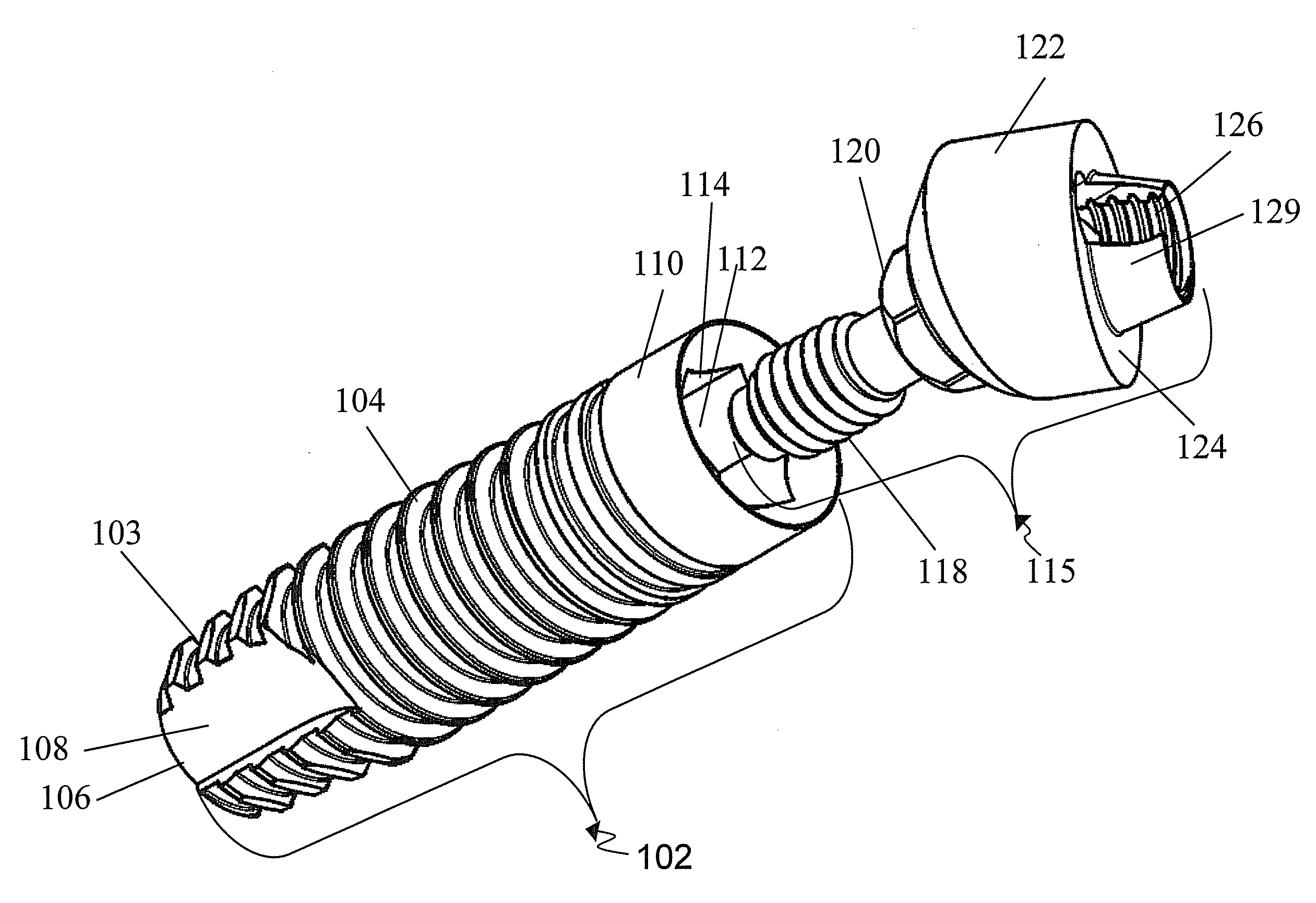 Inclined dental abutment assembly device