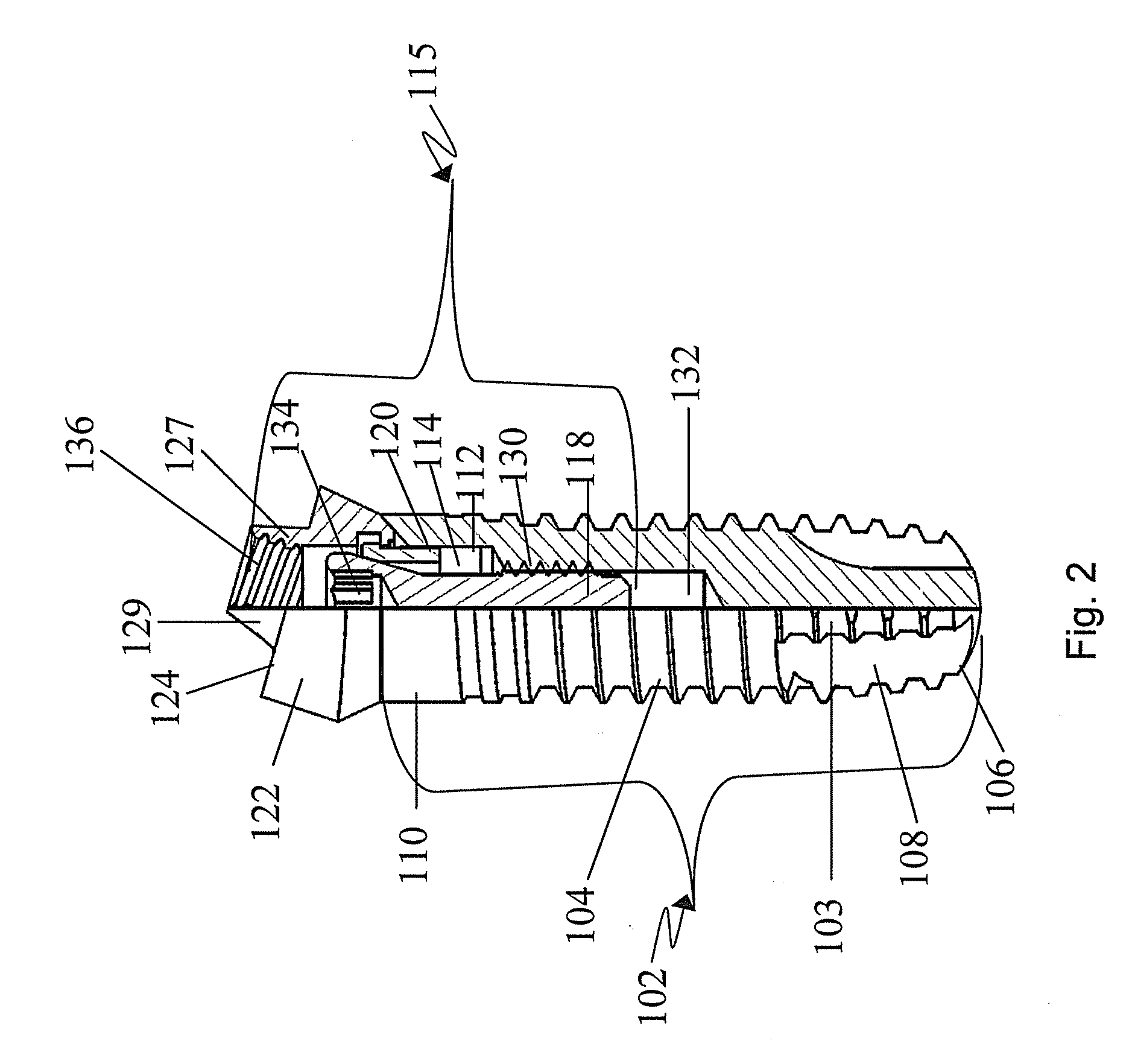 Inclined dental abutment assembly device