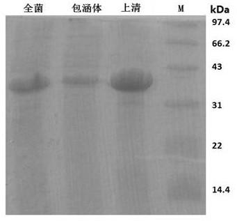 Novel coronavirus N-S dominant epitope fusion protein, preparation method, application, expression protein, microorganism, application and kit