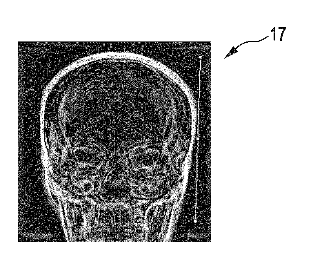 Computed tomography image generation apparatus
