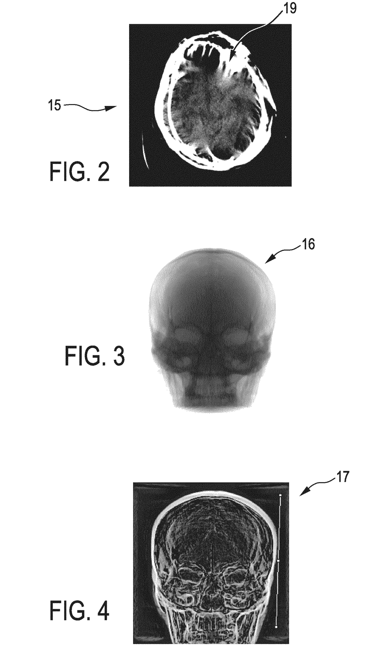 Computed tomography image generation apparatus