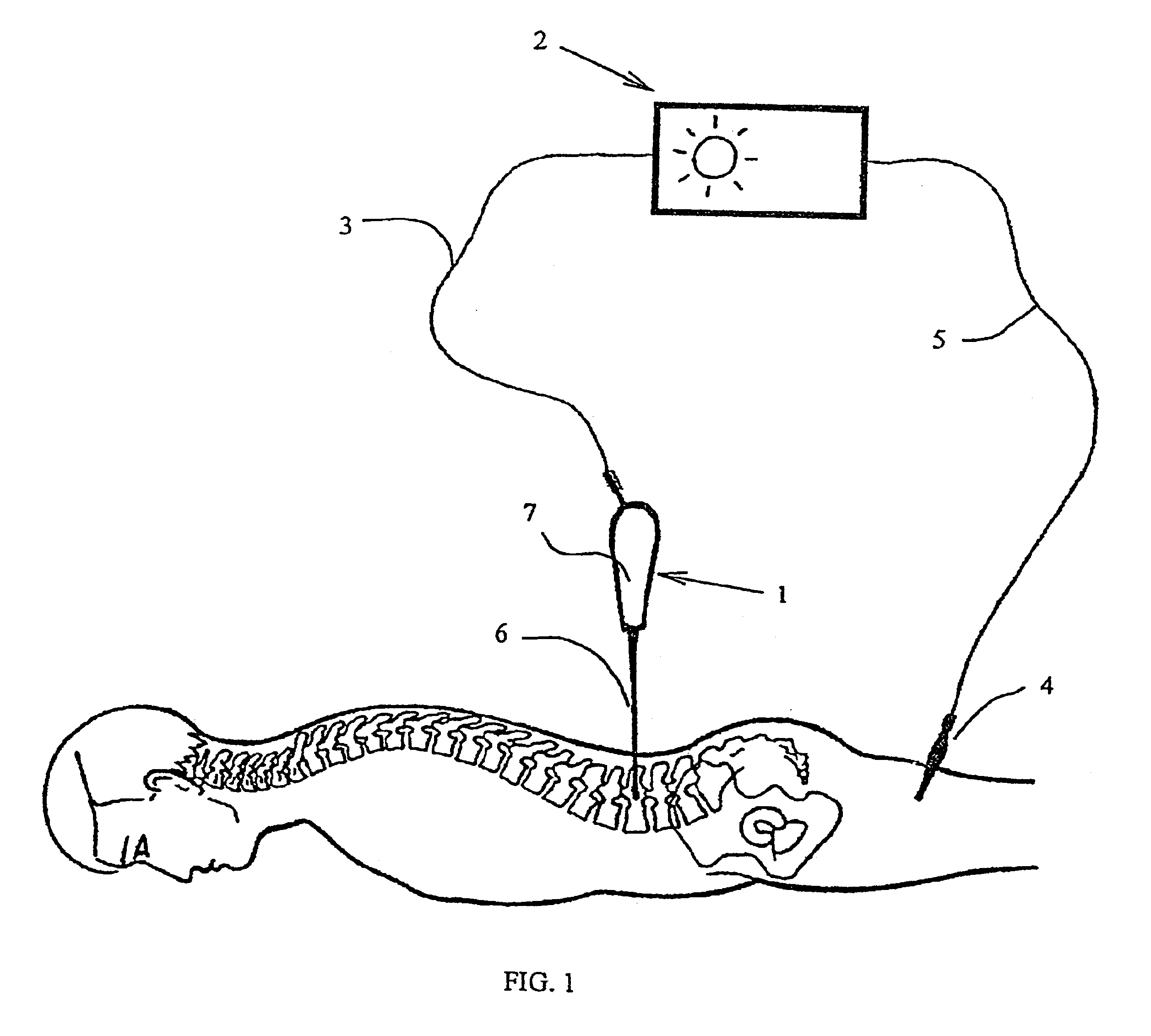 Method for drilling bone, in particular for setting a pedicle screw, equipment, instrument and control device for implementing said method
