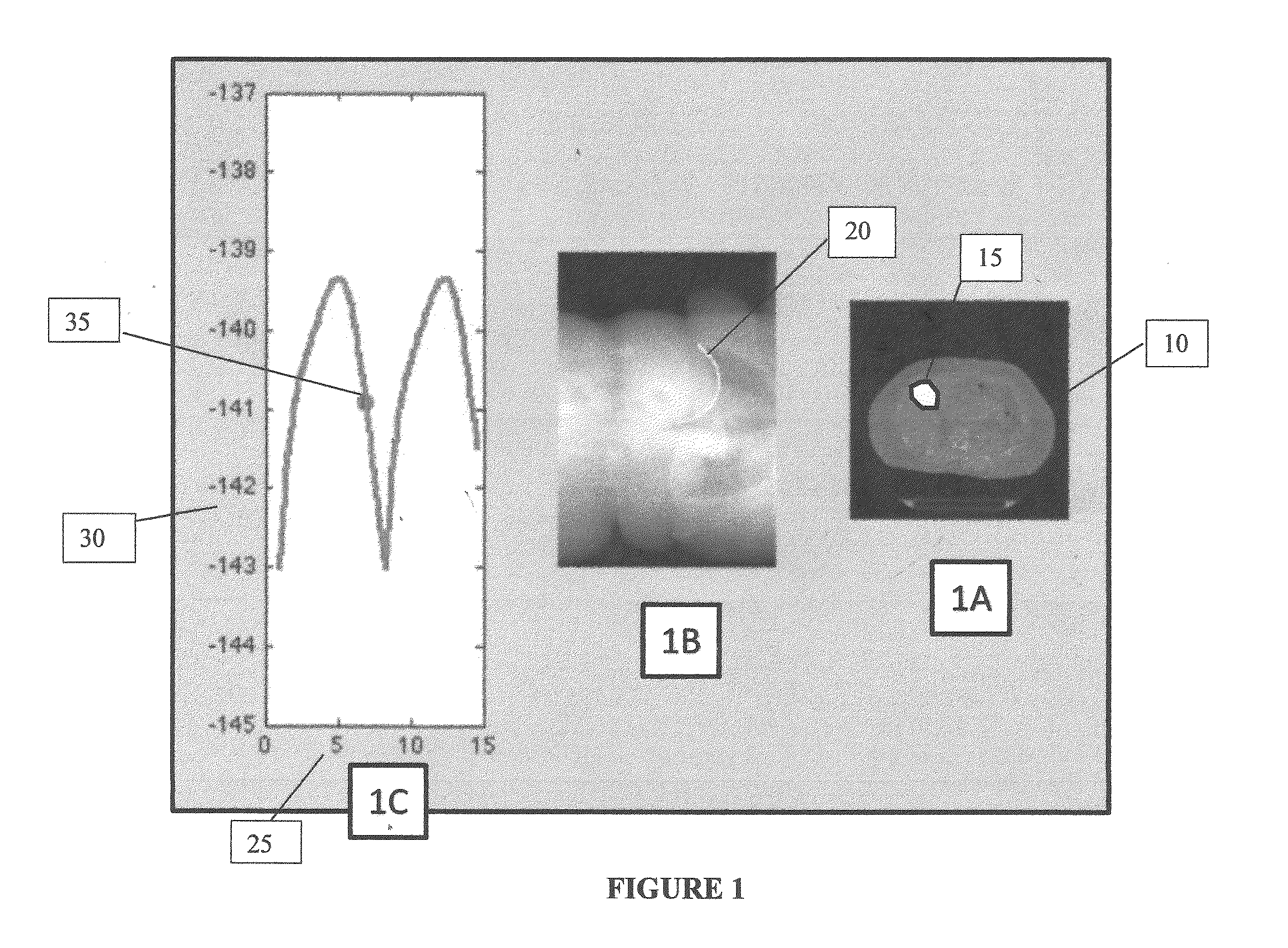 Method for Fiducial-less Real-time Tracking in Radiation Treatment of Abdominal Tumors