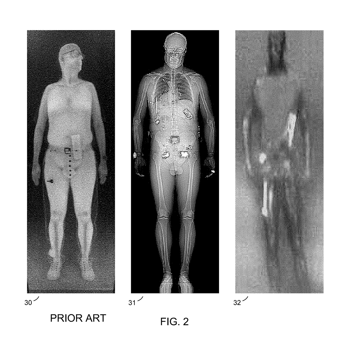 Body Scanner with Automated Target Recognition