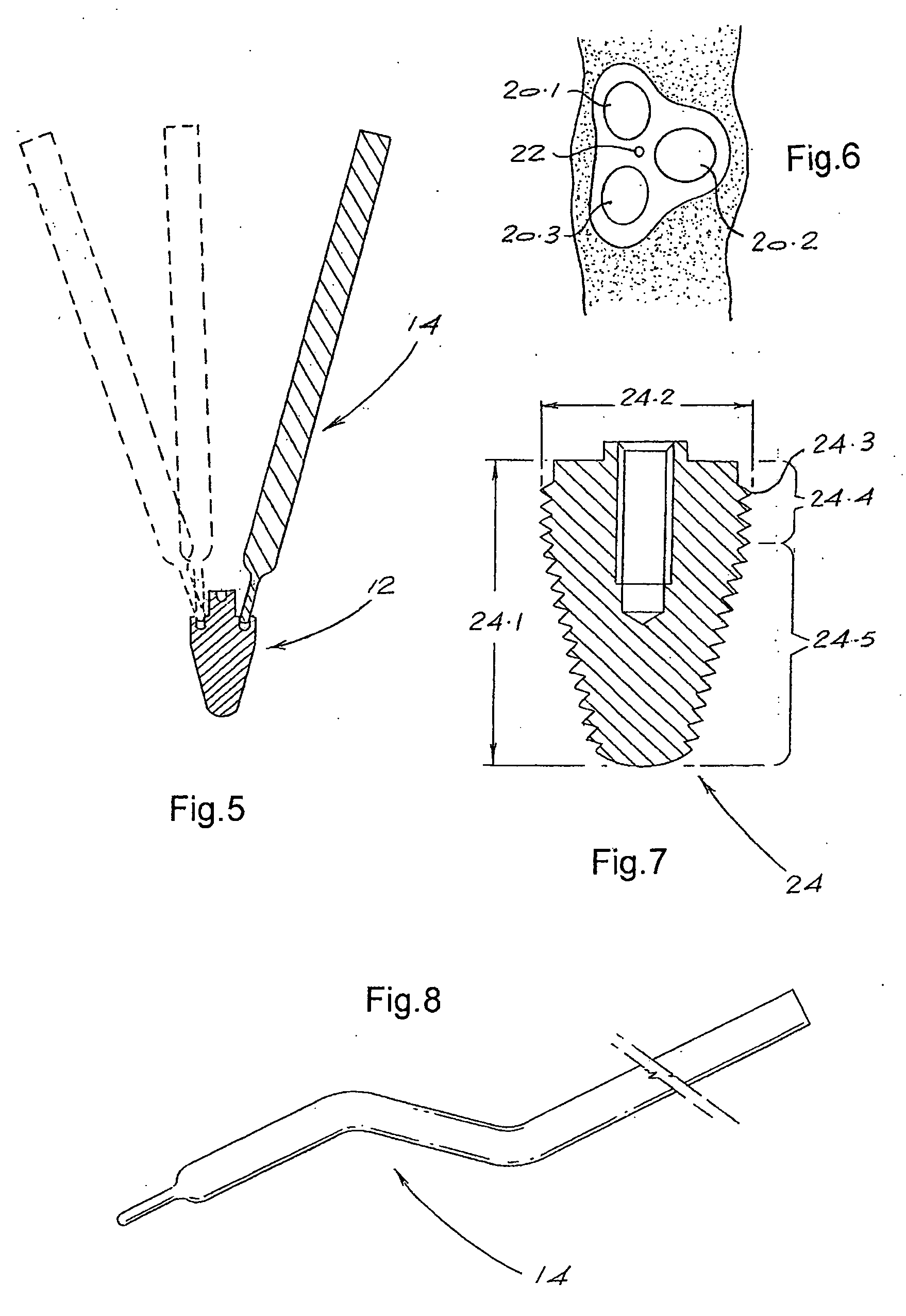 Osteotome and components thereof