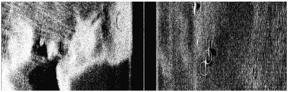 Target detection method of side scan sonar