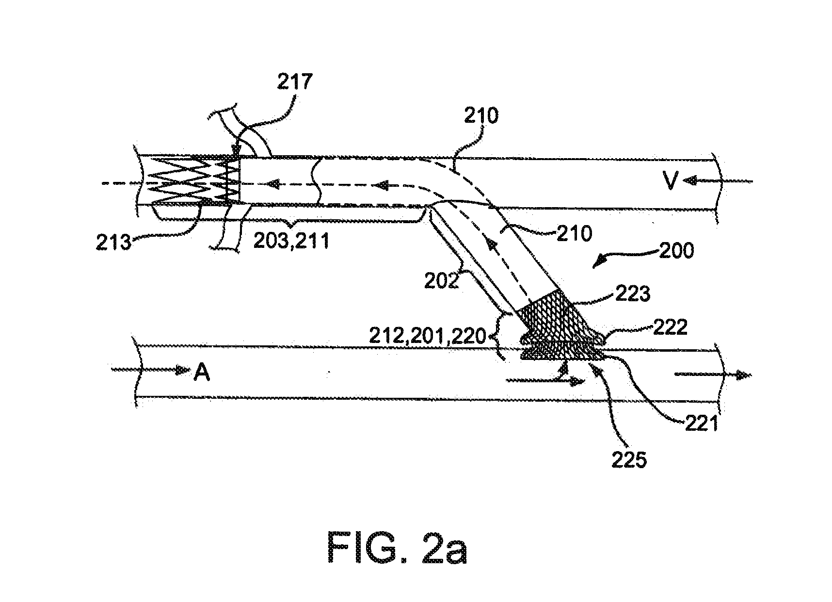 Anastomotic devices and methods