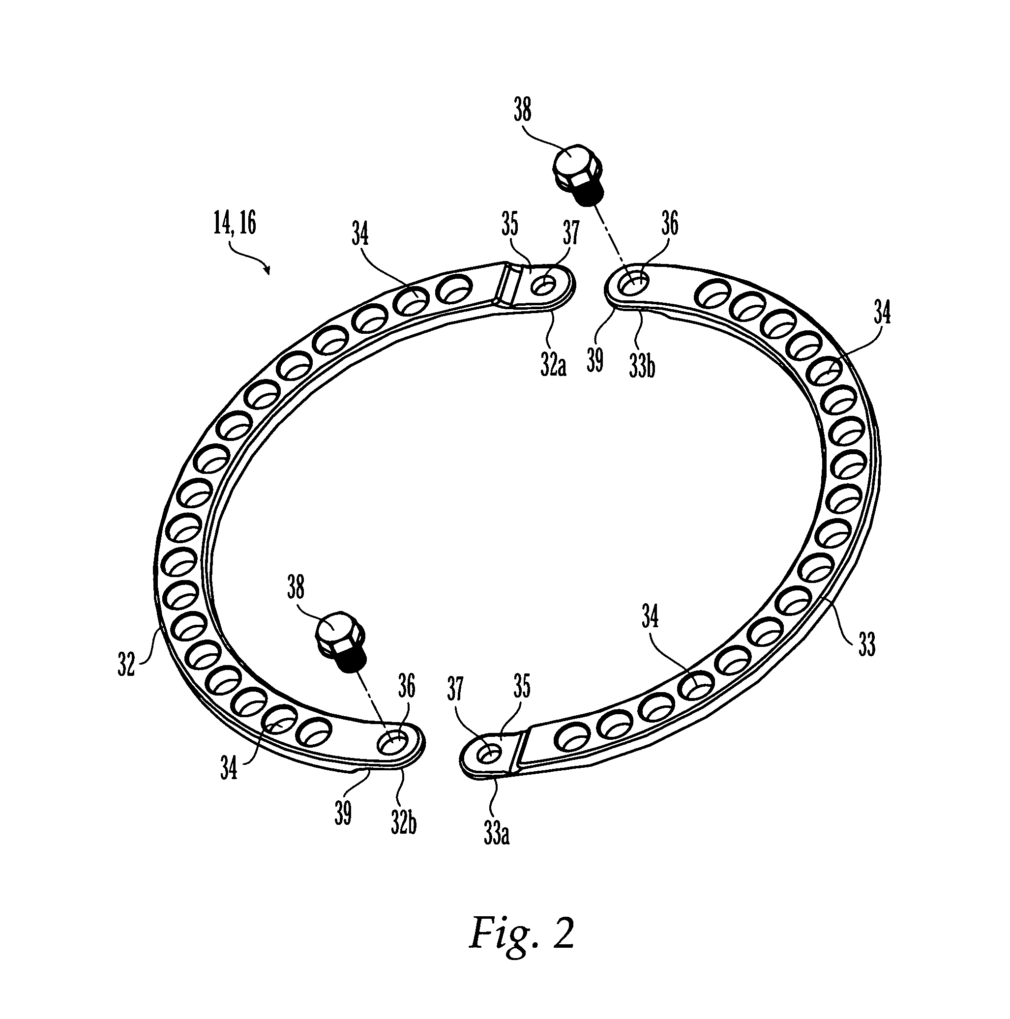 External fixation system and method of use