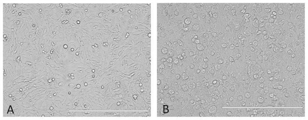 A kind of method that utilizes suspension cell line to prepare Seneca virus