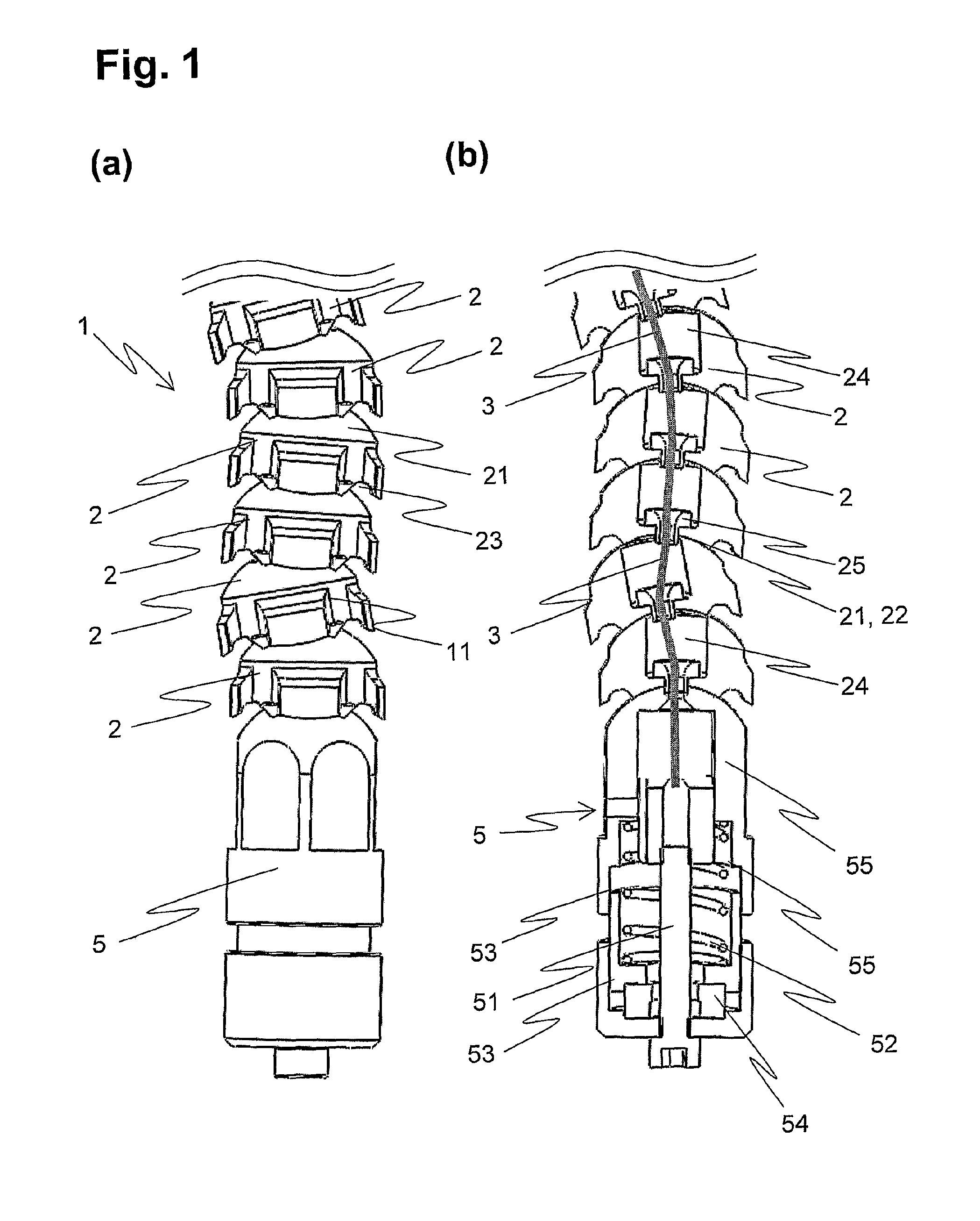 Device for externally fixing bone fractures