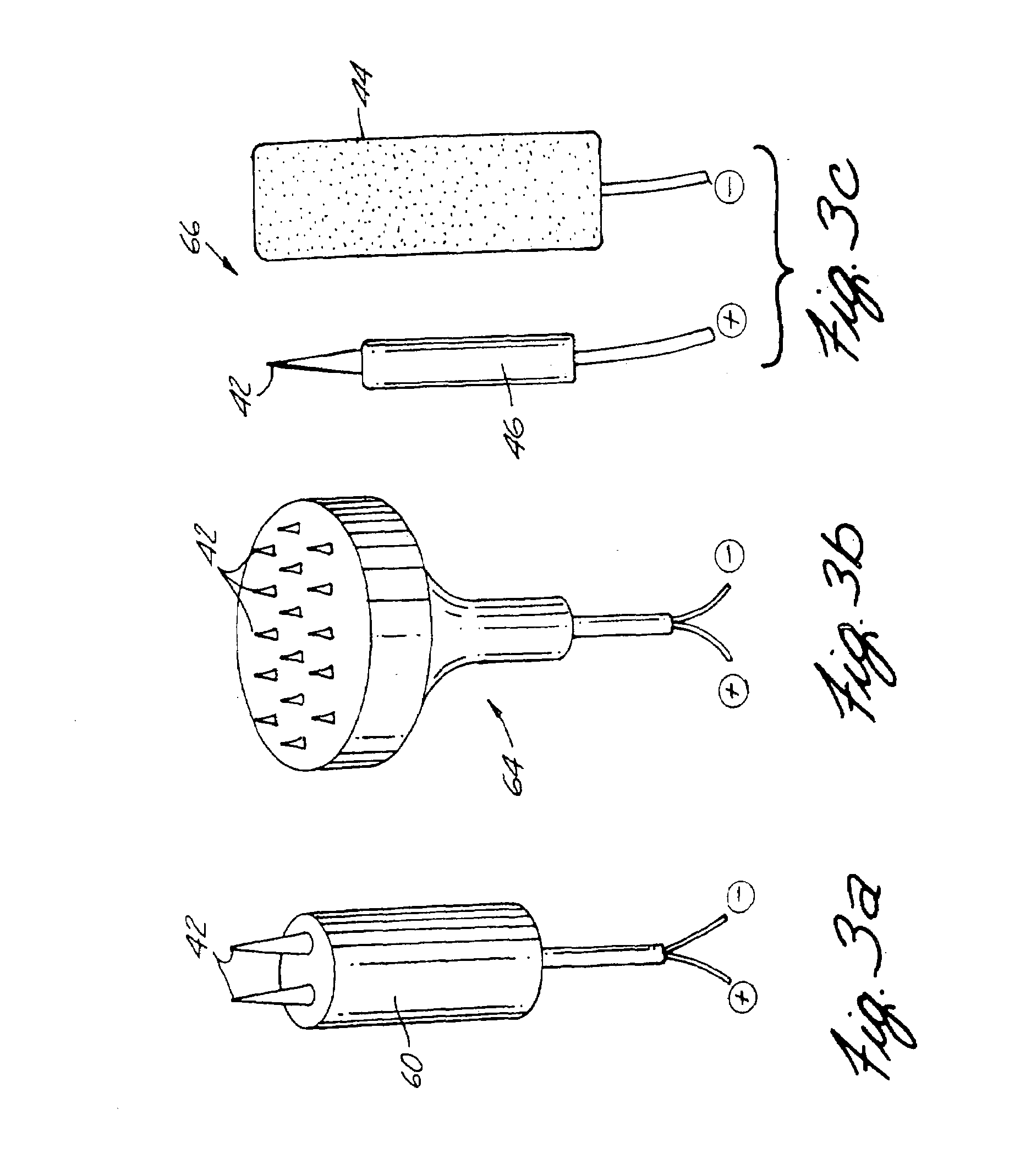 Apparatus and Method for Reducing Subcutaneous Fat Deposits, Virtual Face Lift and Body Sculpturing by Electroporation