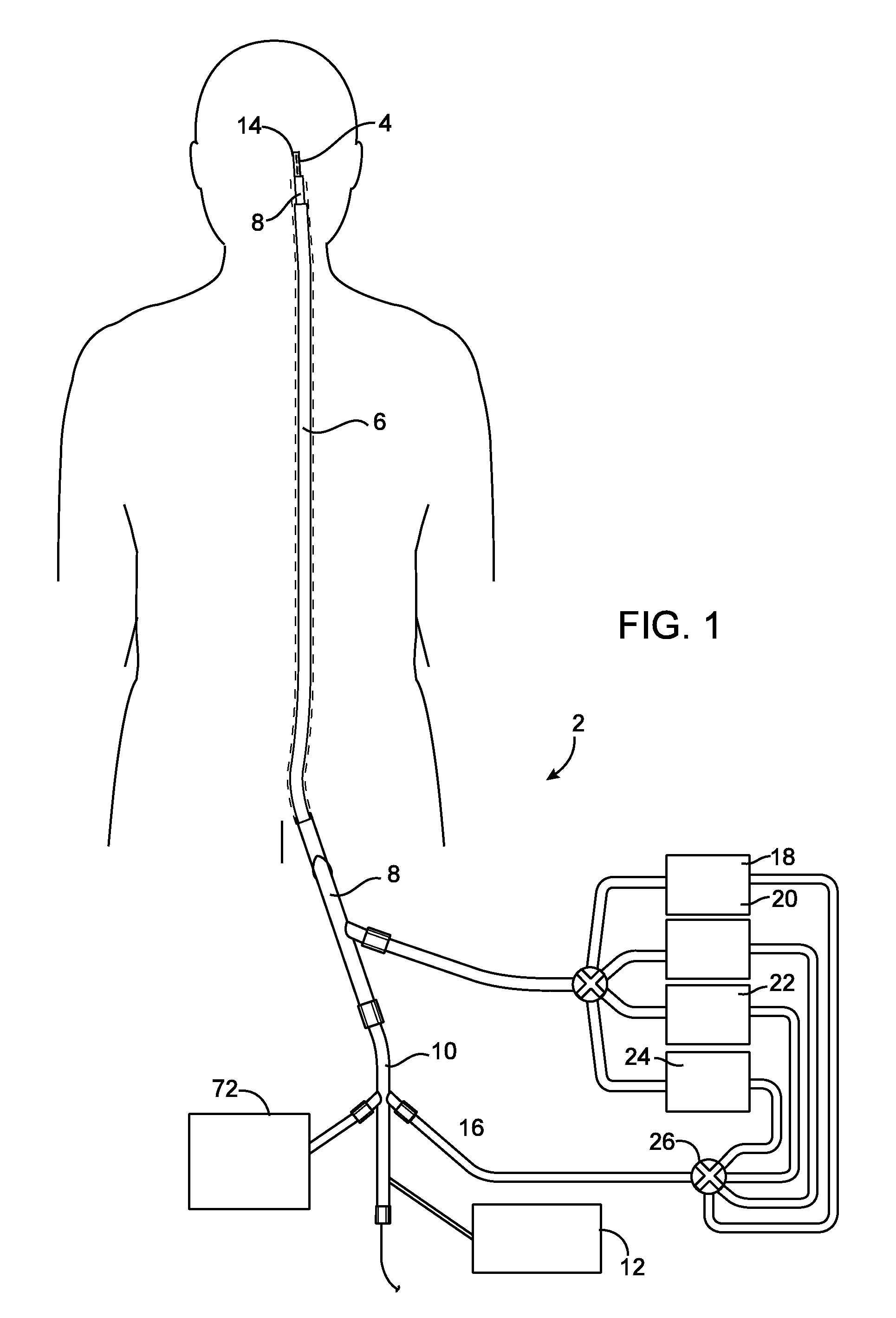 Devices and methods for treating vascular malformations