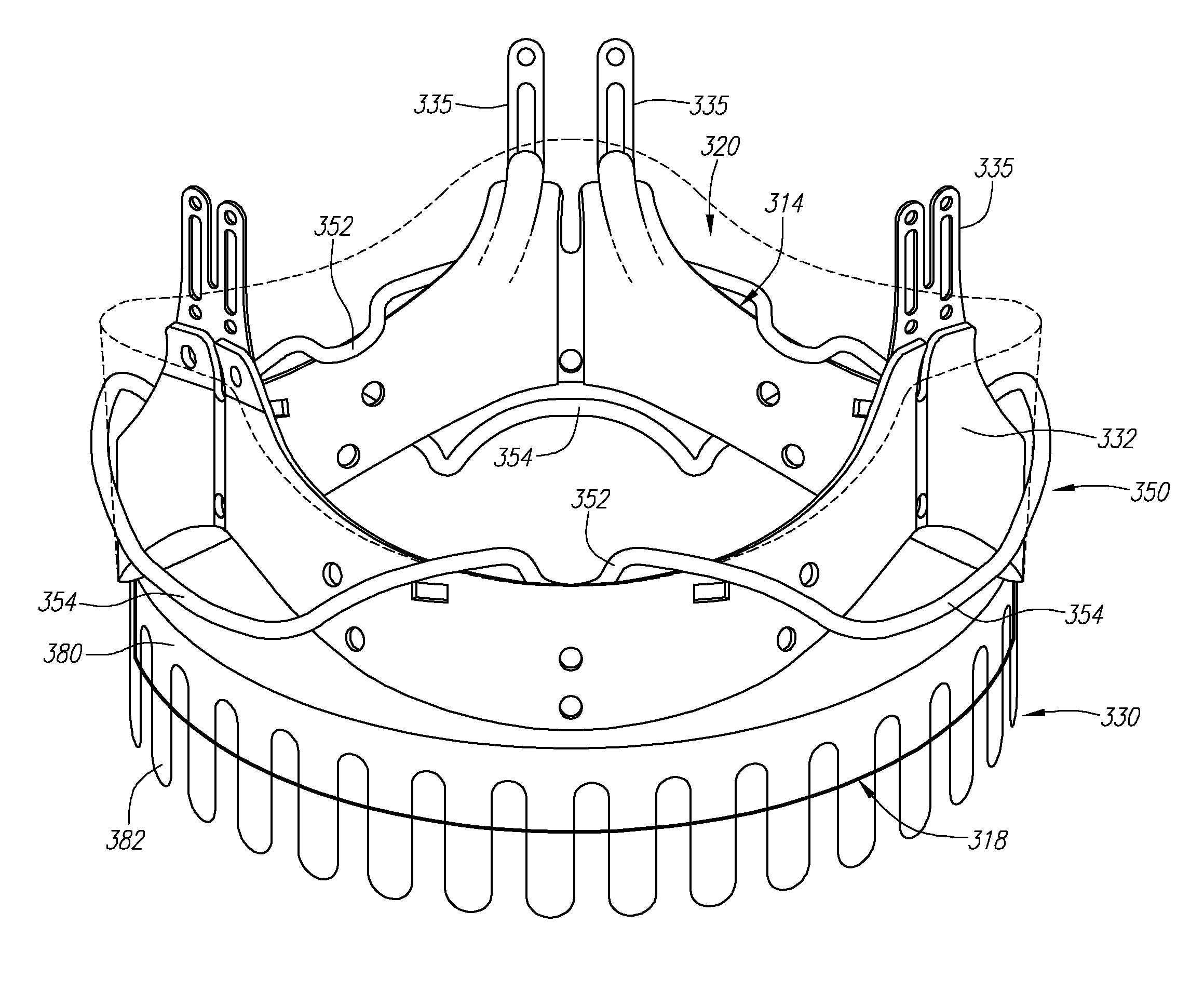Conformable prosthesis for implanting two-piece heart valves and methods for using them
