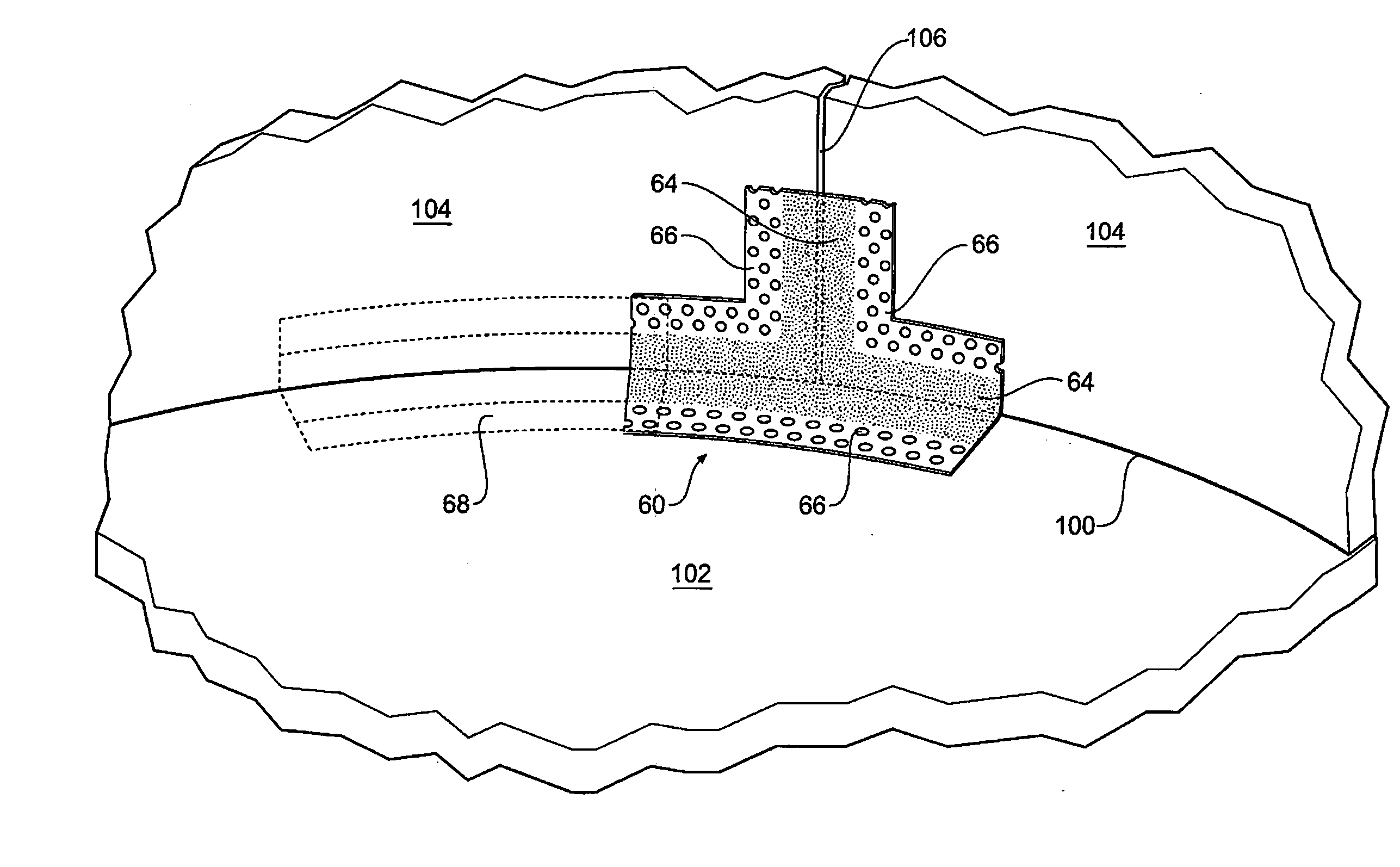 Prefabricated complex joint sealer