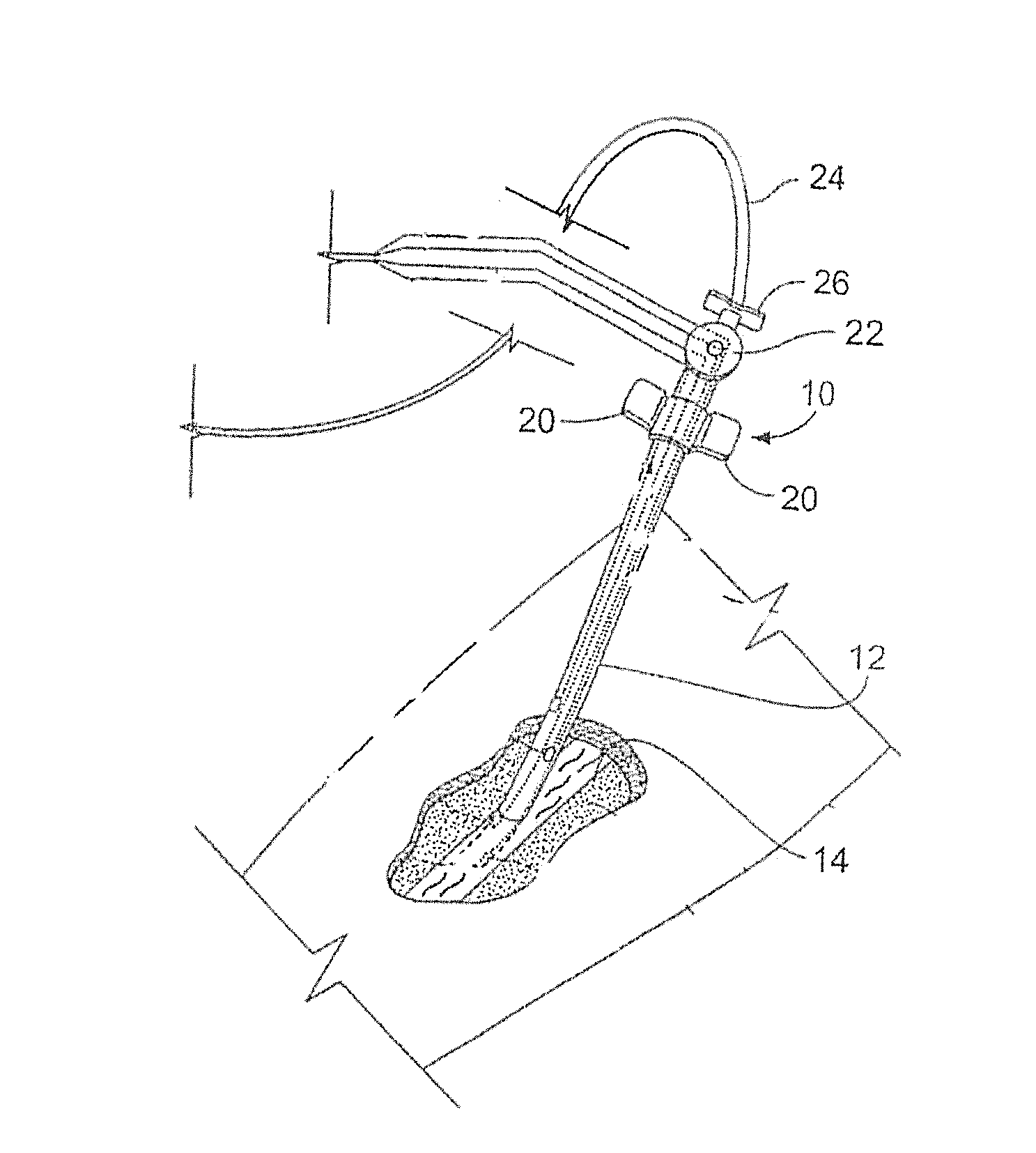 Coated medical apparatus and methods