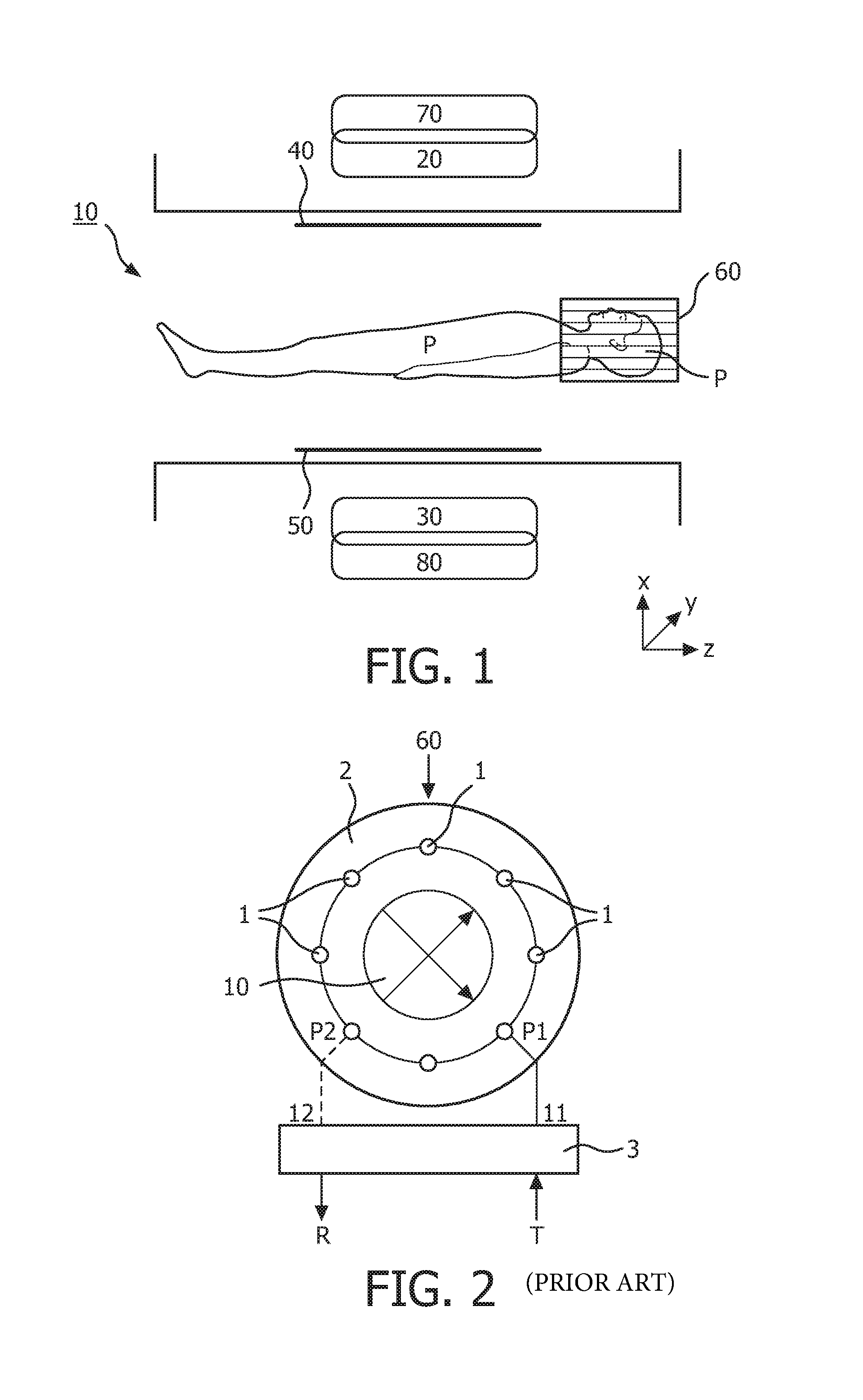 Multichannel RF volume resonator for MRI