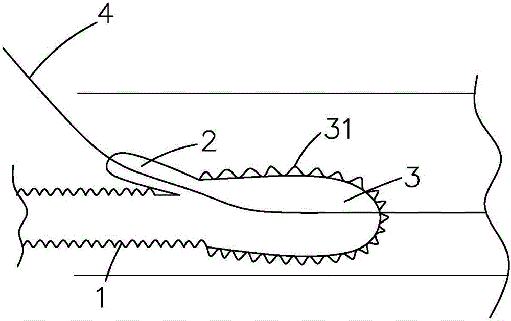 Composite type intraoperative stent system and using method thereof
