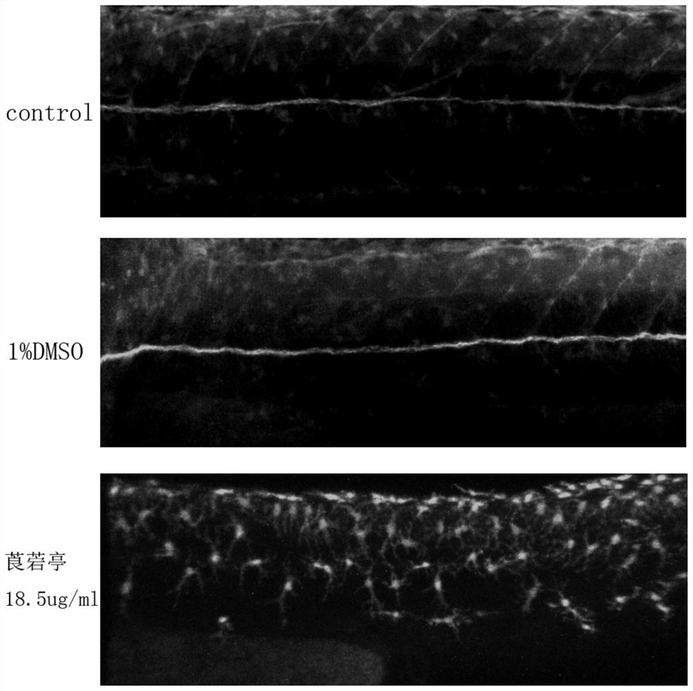 Construction method of transgenic zebrafish (mbp:egfp) spinal cord removal disease model