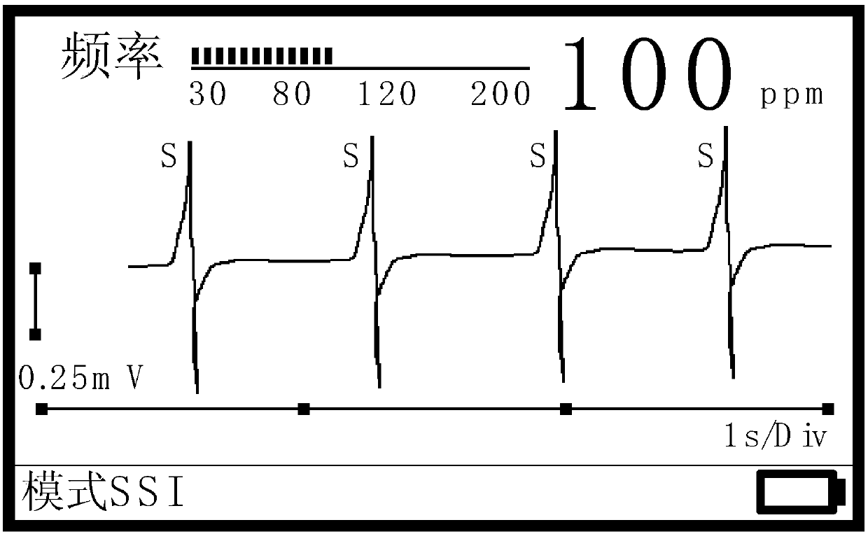 Intracavity electrocardiosignal processing and display method and temporary cardiac pacemaker having function