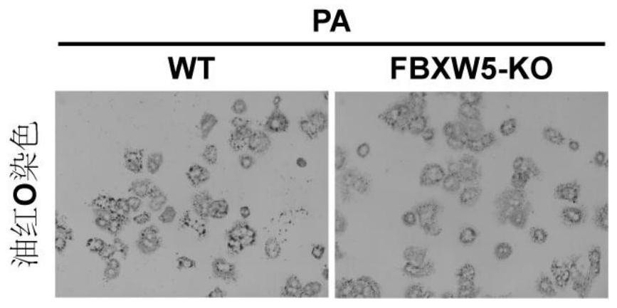 Application of fbxw5 and its inhibitors in the preparation of drugs for the treatment of fatty liver and related diseases
