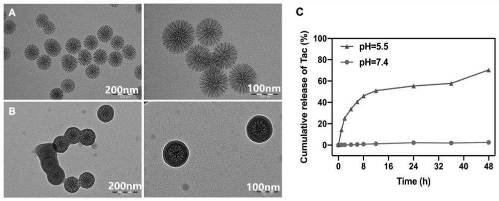 Novel nano sustained-release drug-loaded material for inhibiting antibody-mediated rejection reaction in targeted immune hair growth center, preparation method and application of novel nano sustained-release drug-loaded material