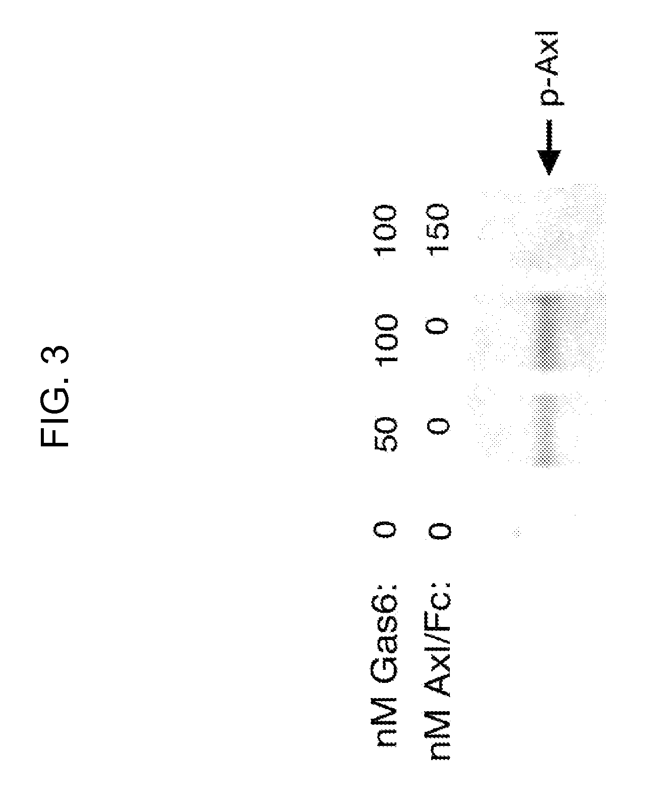 Axl tyrosine kinase inhibitors and methods of making and using the same