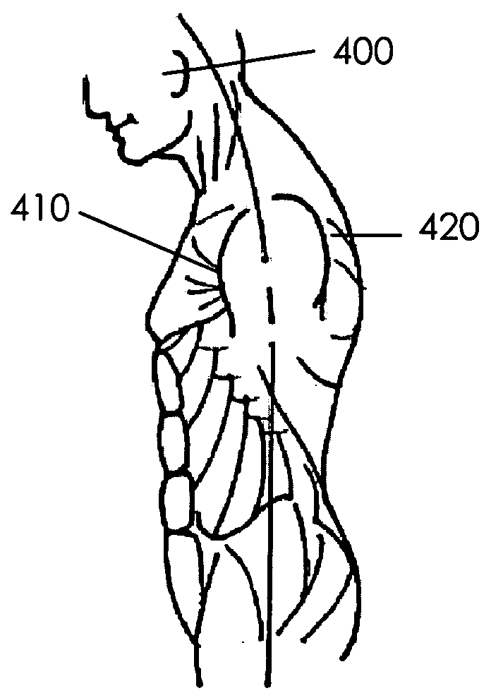 Method and apparatus for torso muscle lengthening