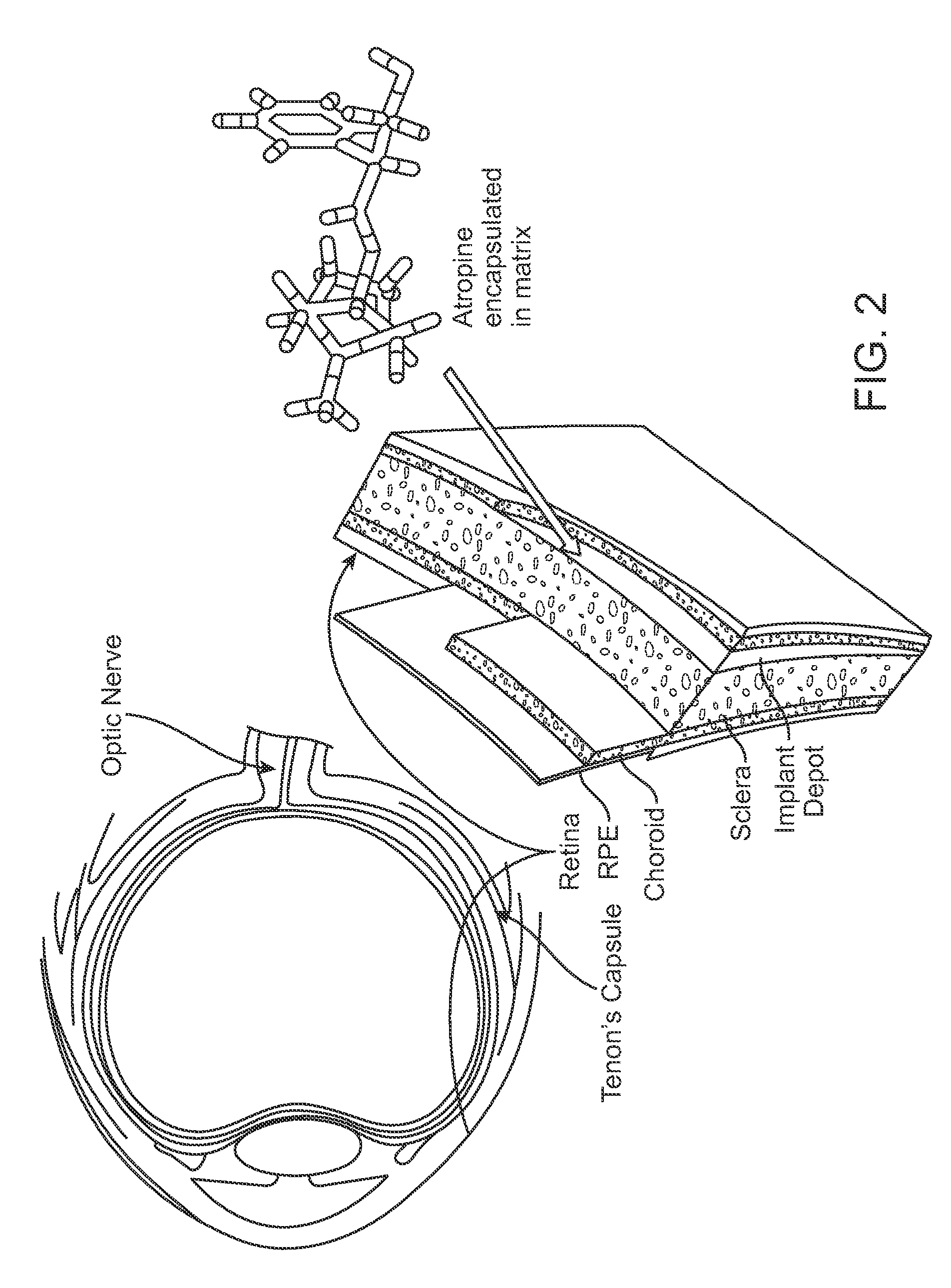 Implantable Delivery Vehicle for Ocular Delivery of Muscarinic Antagonists