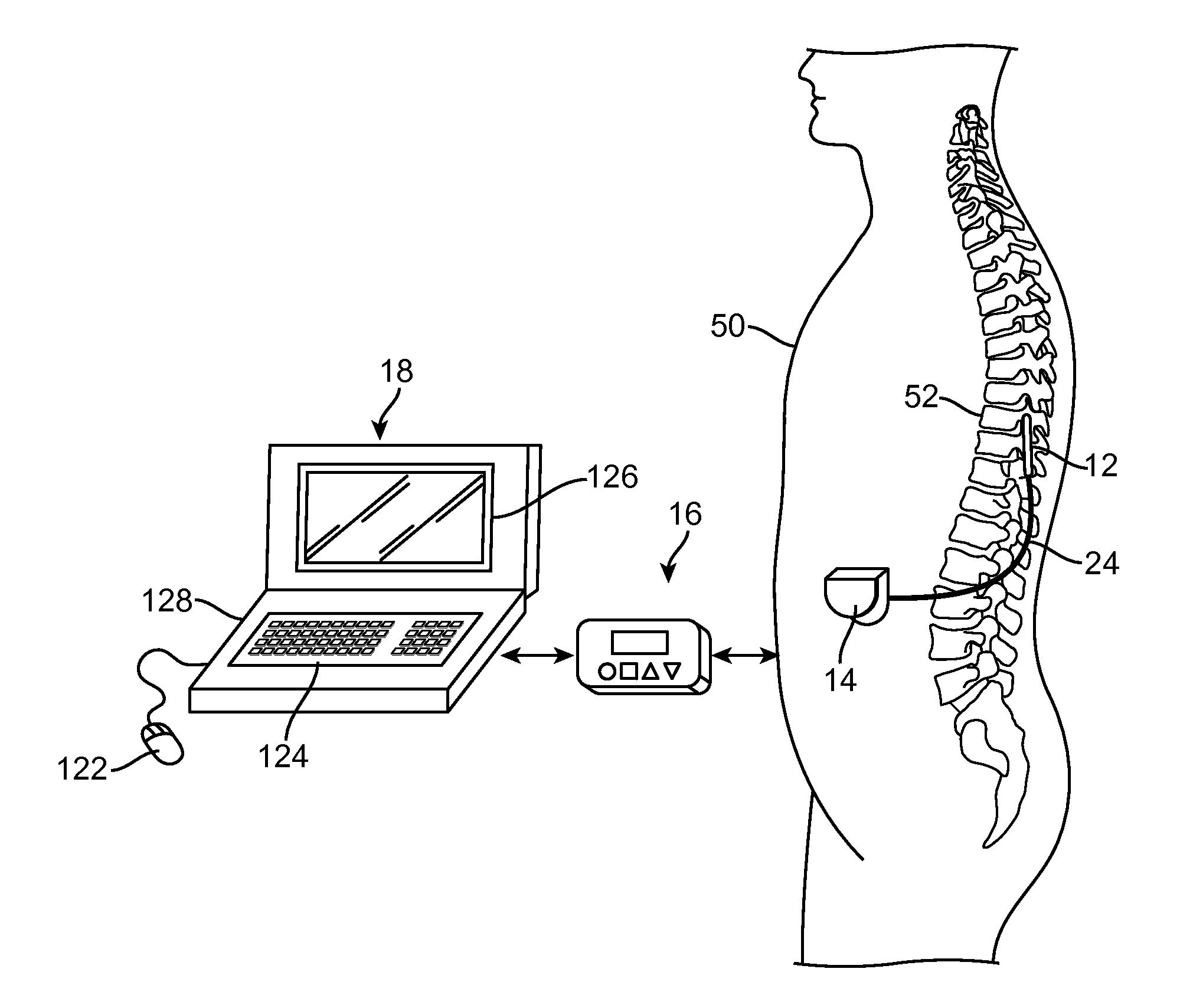 System and method for storing application specific and lead configuration information in neurostimulation device
