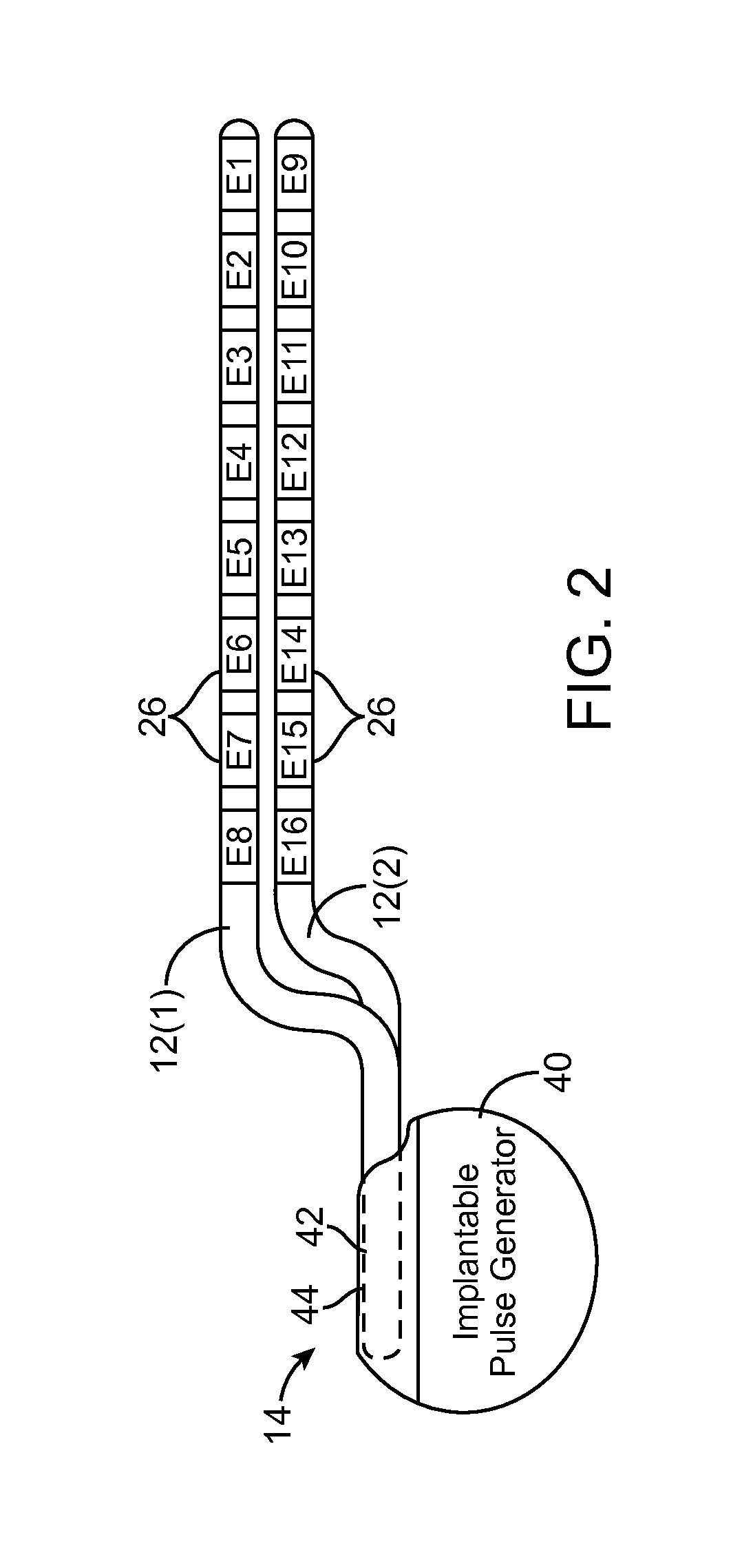 System and method for storing application specific and lead configuration information in neurostimulation device