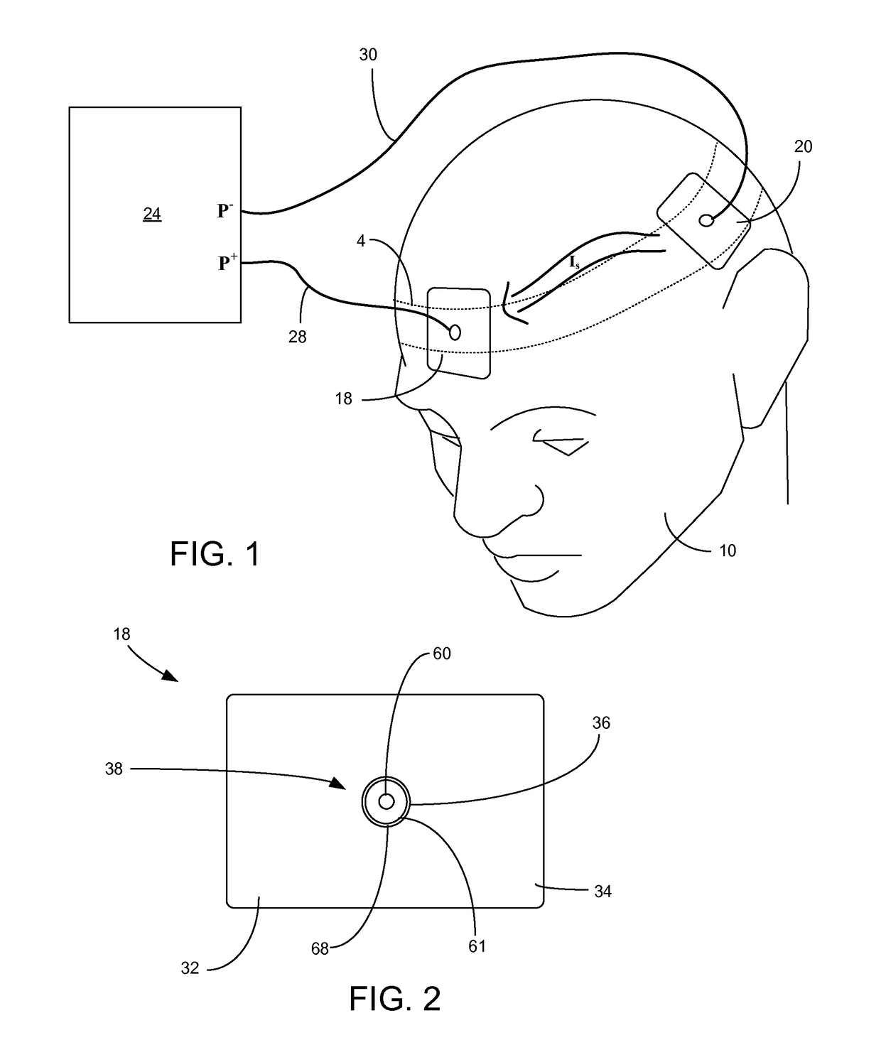 Transcranial direct current brain stimulation apparatus