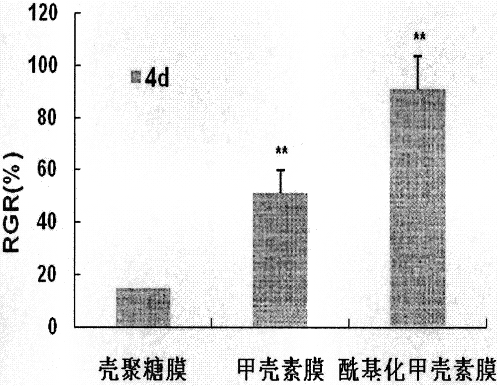 A kind of degradable vascular stent and its preparation method and application