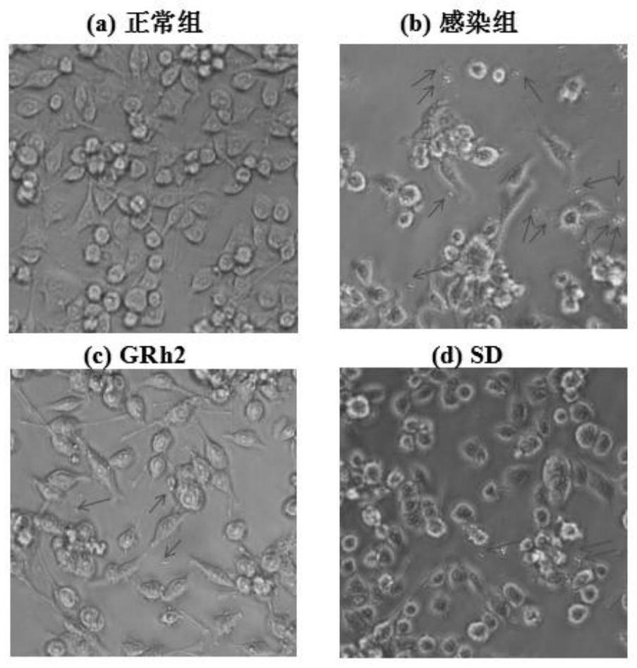 Application of a kind of ginsenoside grh2 in the preparation of anti-toxoplasma compound preparation and its medicine