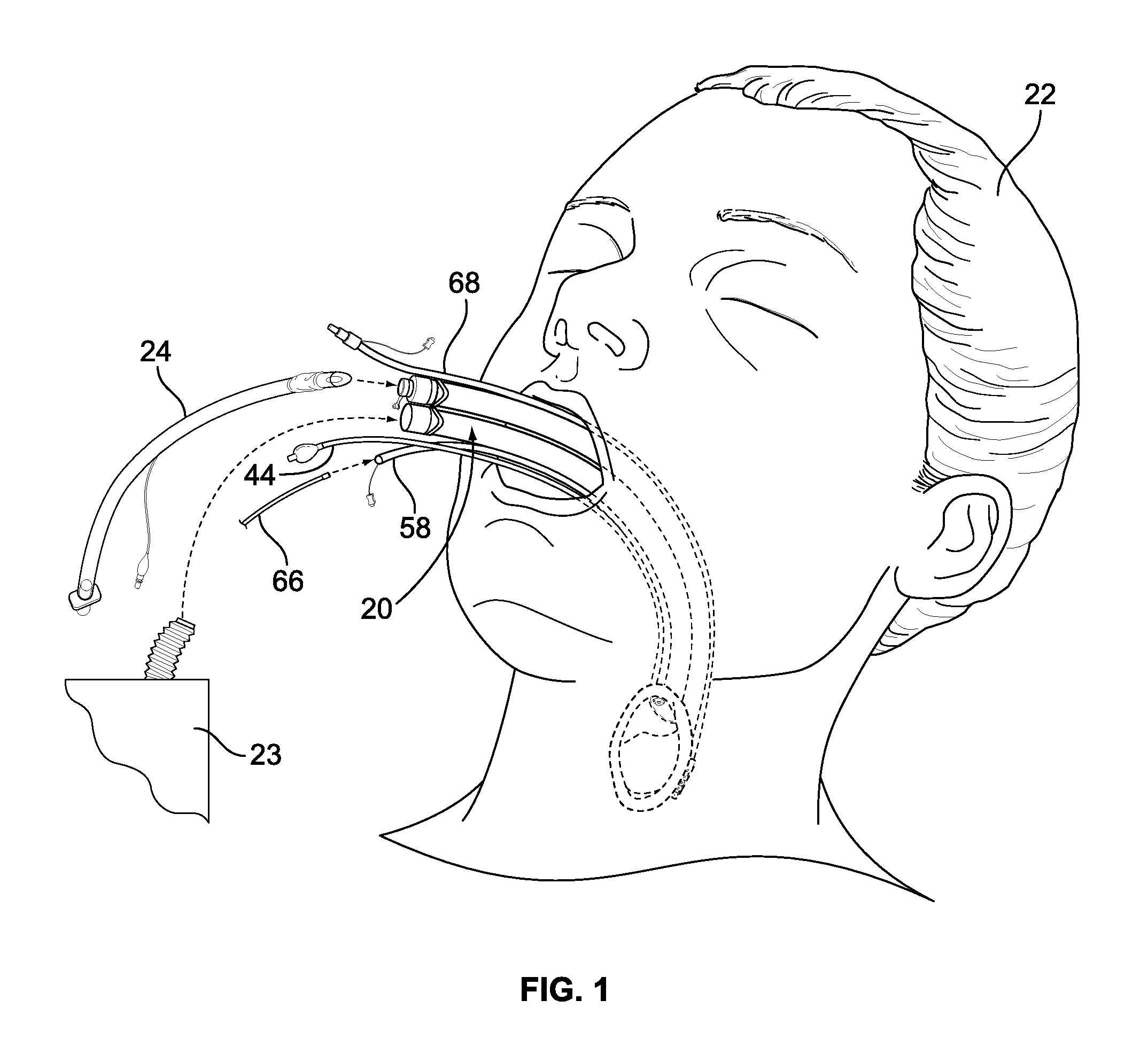 Medical device, and the methods of using same