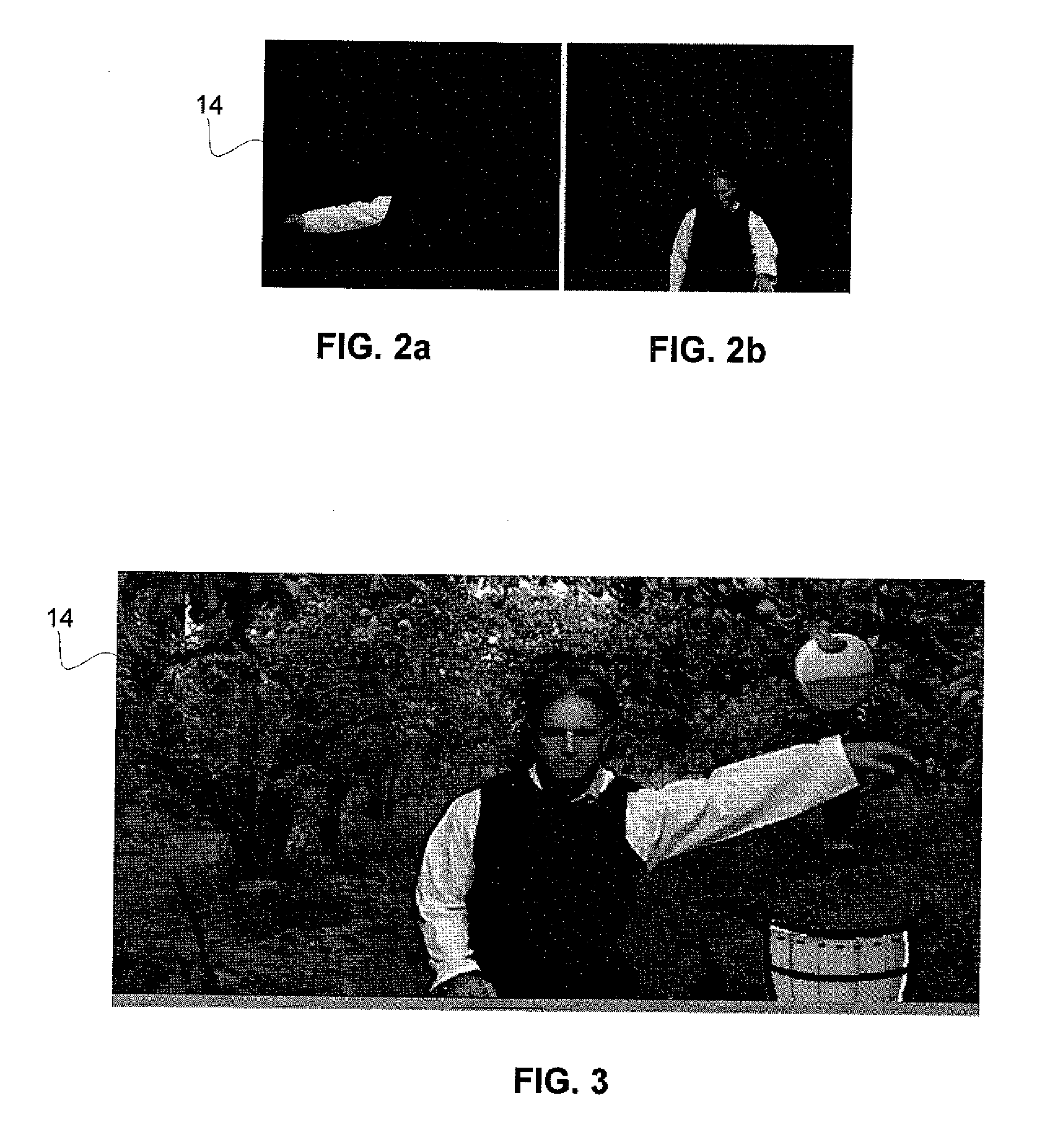 System and method for treating chronic pain