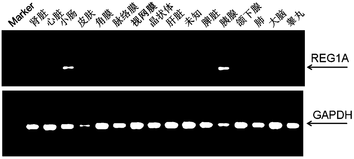 Application of reg1a protein in preparation of medicine for treating and/or preventing retinal cell apoptosis