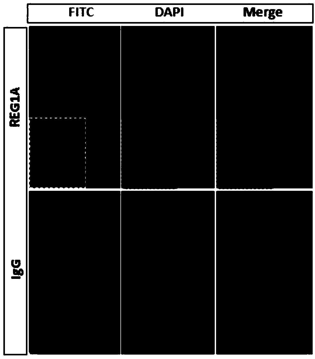 Application of reg1a protein in preparation of medicine for treating and/or preventing retinal cell apoptosis