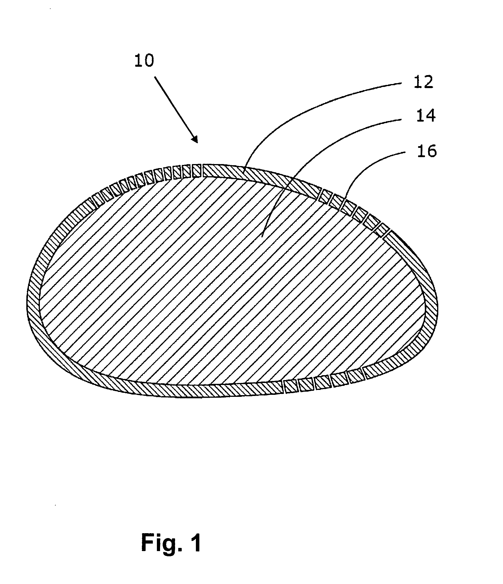 Biocompatible implant system and method