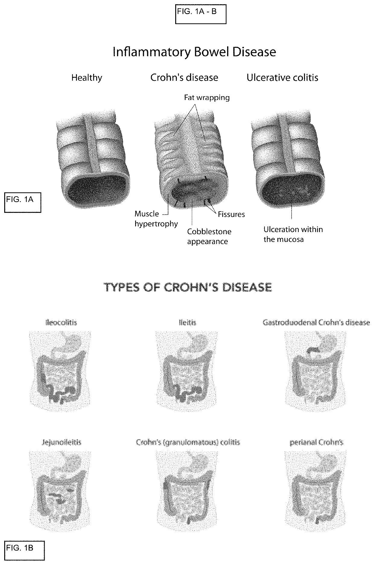 In vitro gastrointestinal model comprising lamina propria-derived cells