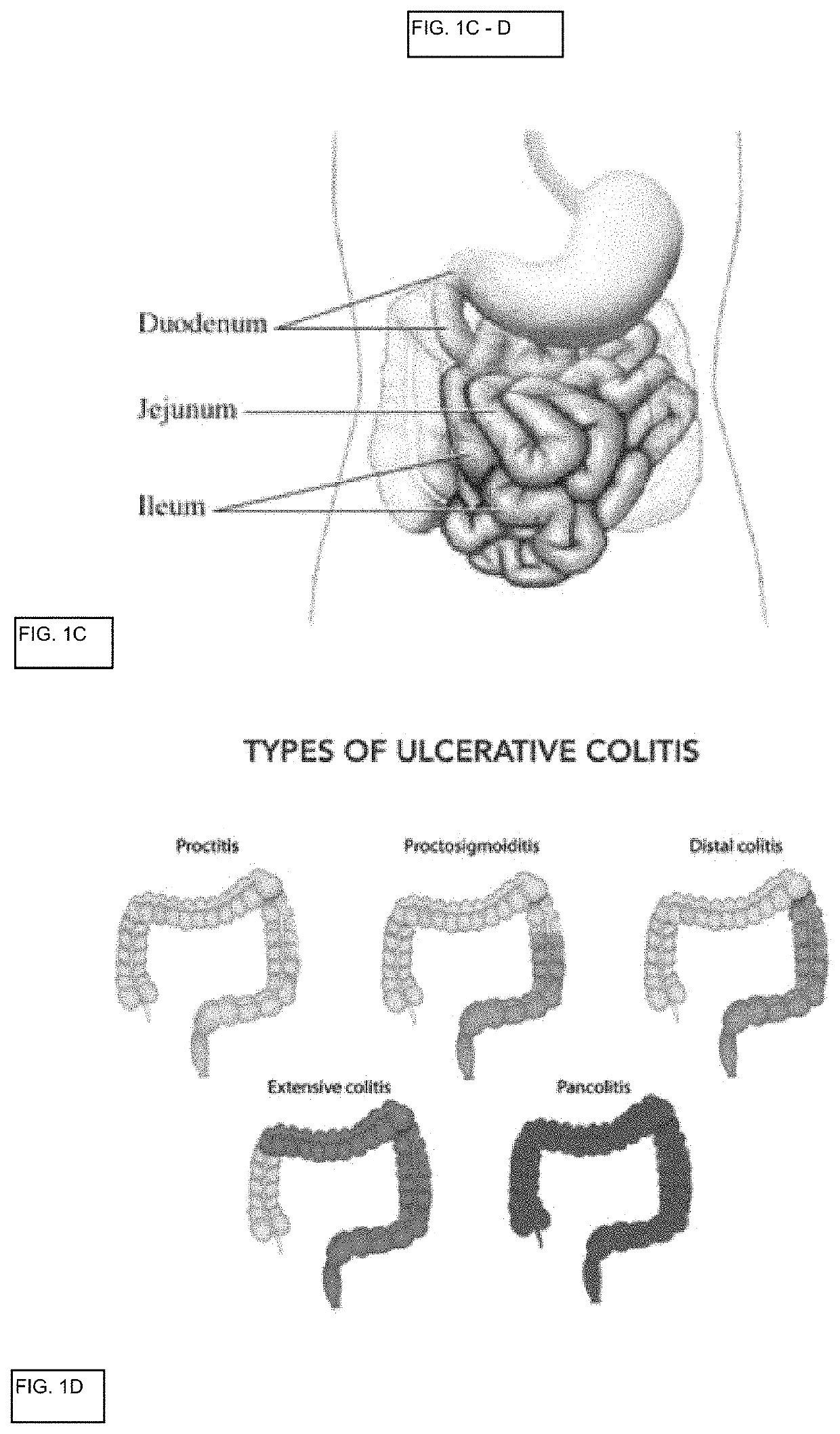 In vitro gastrointestinal model comprising lamina propria-derived cells