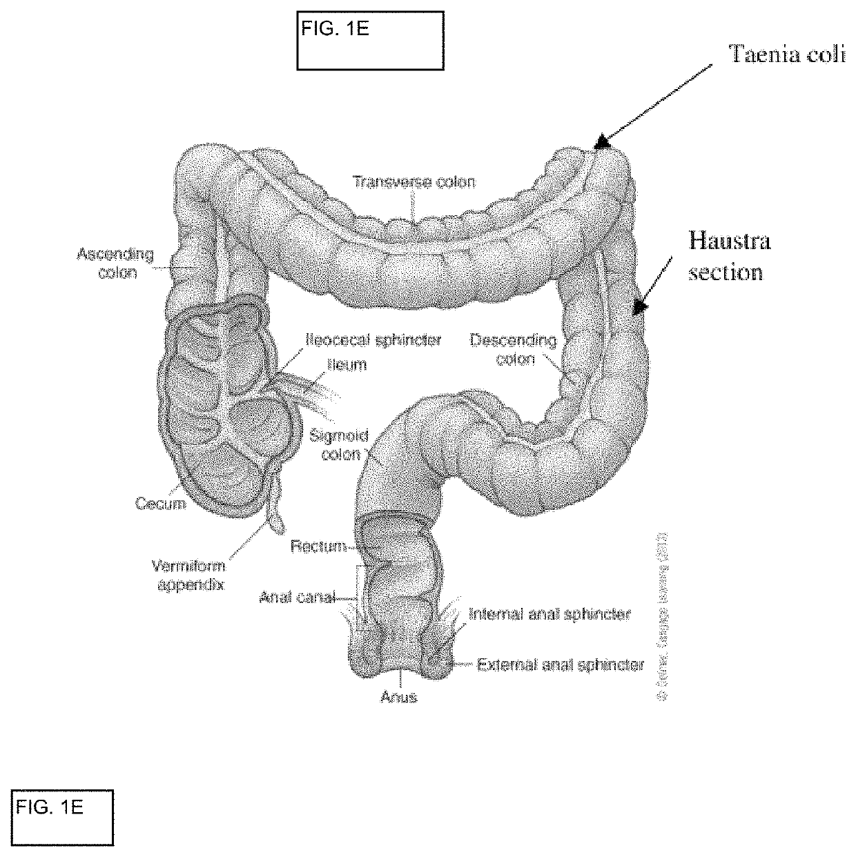 In vitro gastrointestinal model comprising lamina propria-derived cells