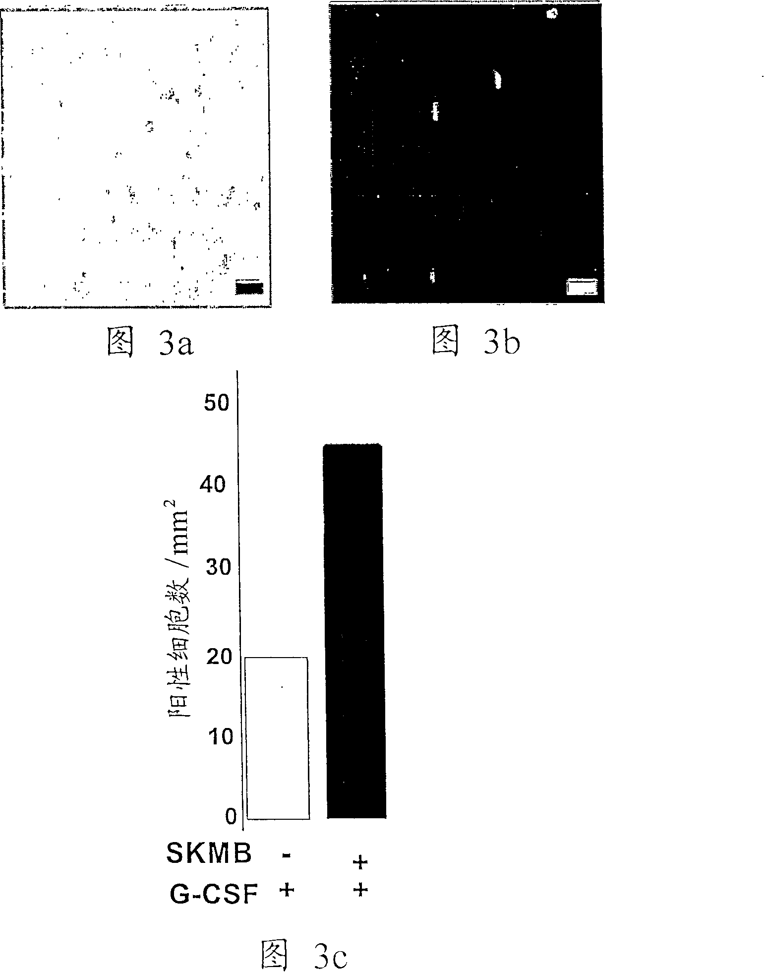 Stromal cell-derived factor-1 mediates stem cell homing and tissue regeneration in ischemic cardiomyopathy