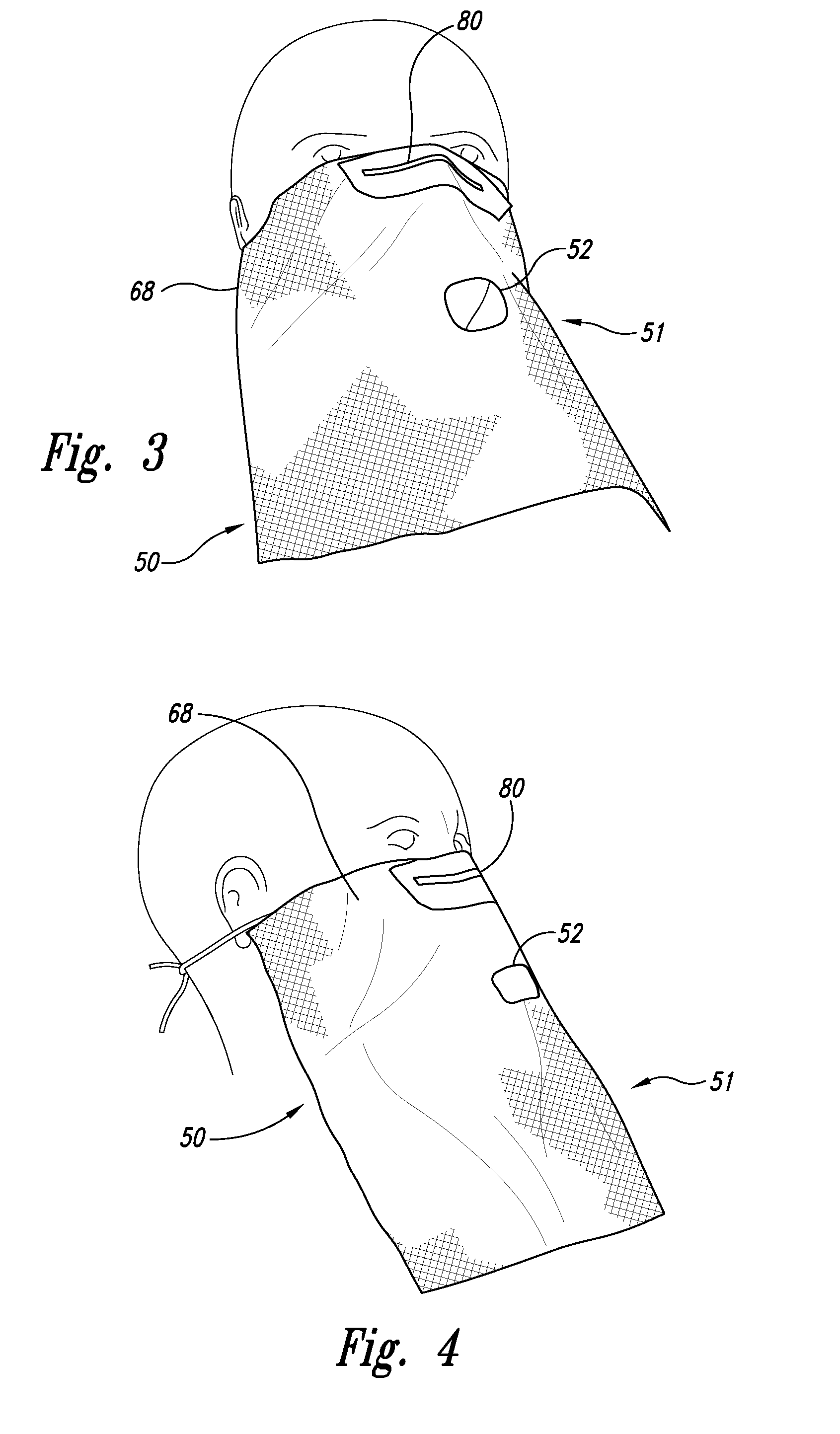 Systems and methods for detection of disease including oral scopes and ambient light management systems (ALMS)