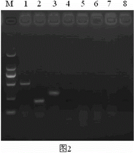 Triple RT-PCR detection kit