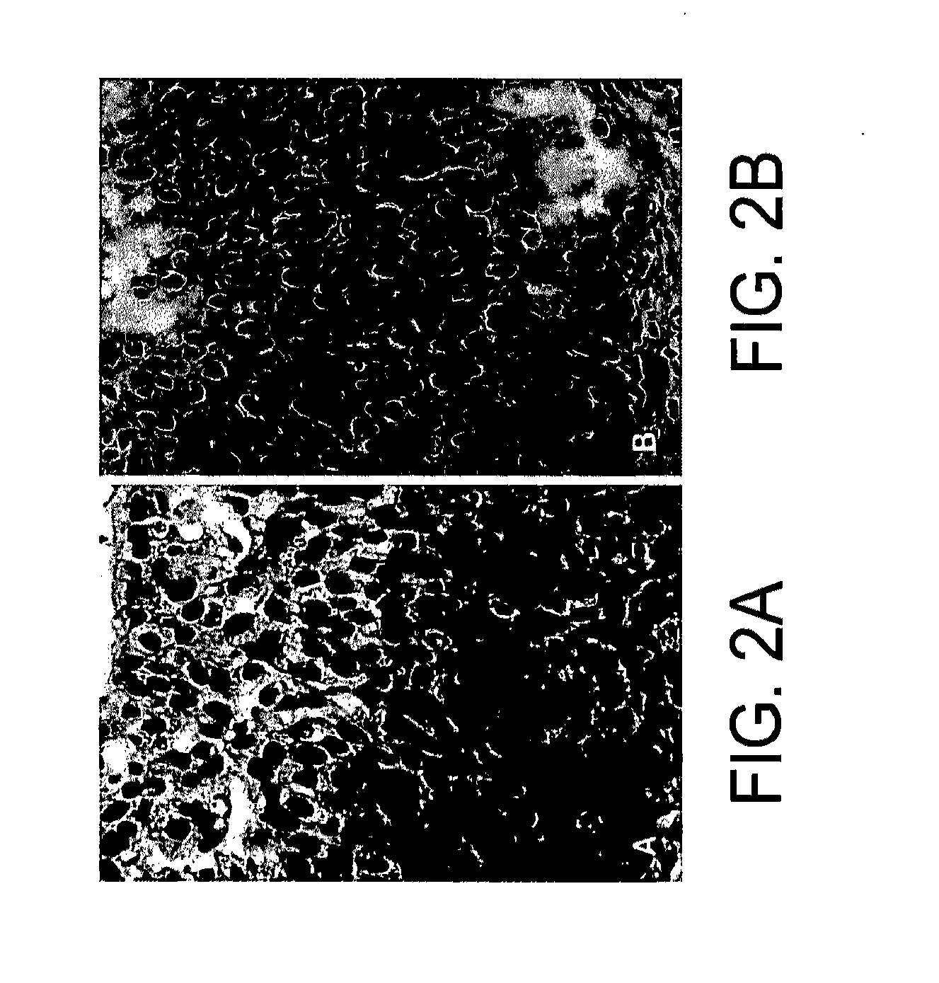 Kits for and methods of differential staining of cervical cancer cells and/or tissues